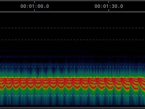 Sonogramm 4