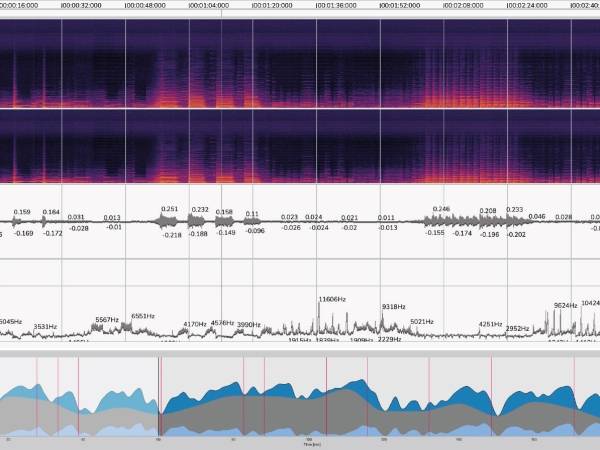 Deconvolved Electrodermal Activity shown below analysis